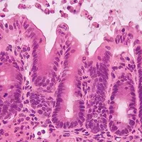 inflammation in mice gut inflammation in mice gut
